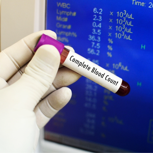 CBC BLOOD TEST | REHANSHI DIAGNOSTICS | F 149 TIRUPATI COMPLEX KALOL AMBIKANAGAR AHMEDABAD MAHESANA HIGHWAY KALOL 382721  COMPLEX KALOL AMBIKANAGAR AHMEDABAD MAHESANA HIGHWAY KALOL 382721