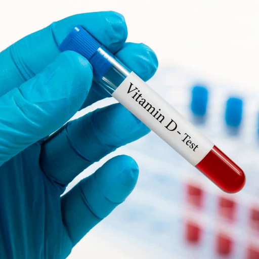 Vitamin D3 Test | REHANSHI DIAGNOSTICS | F 149 TIRUPATI COMPLEX KALOL AMBIKANAGAR AHMEDABAD MAHESANA HIGHWAY KALOL 382721  COMPLEX KALOL AMBIKANAGAR AHMEDABAD MAHESANA HIGHWAY KALOL 382721