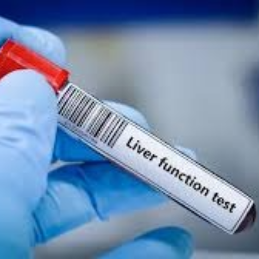 Liver function test TAKSHVI DIAGNOSTIC CENTRE BLOCK E 2 4TH 402 ARON ELEGANCE OPP RADHEY BUNGLOWS NEW AHMEDABAD 382424