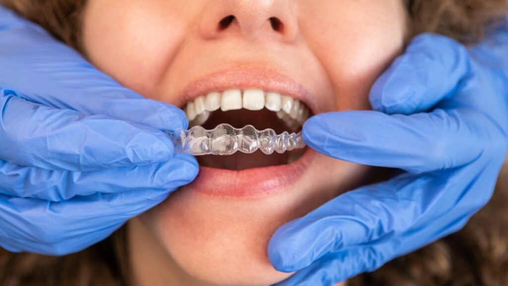 Invisalign-West-Hollywood-1.jpg