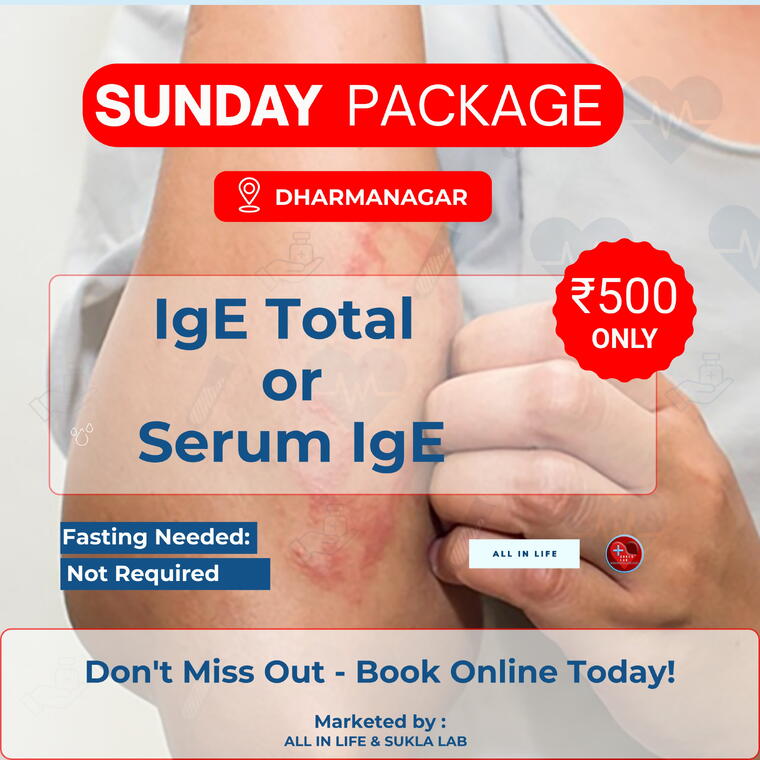TOTAL IGE OR SERUM IGE SUKLA SUNDAY PACKAGE