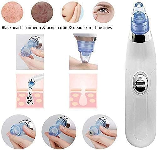 Blackhead Remover Vacuum (USB Suction Tool)