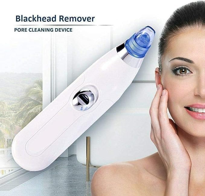 Blackhead Remover Vacuum (USB Suction Tool)