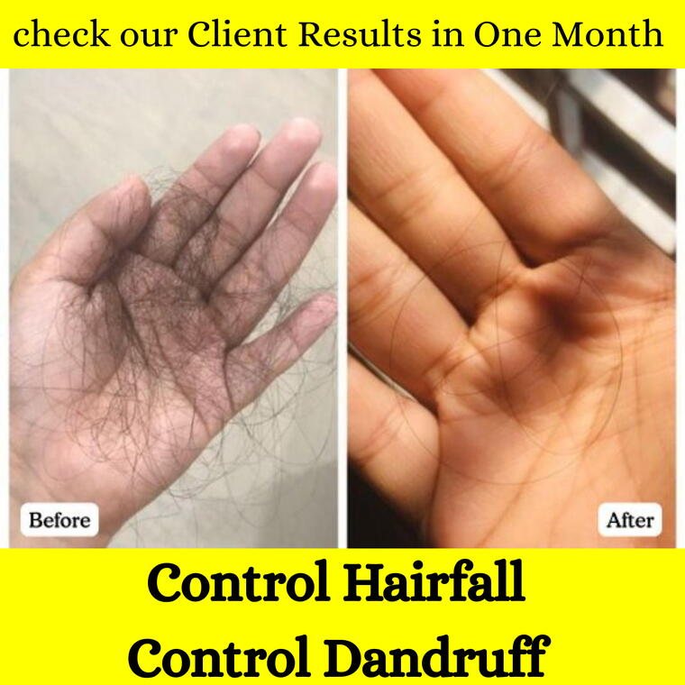 Anvira herbal hair oil (Pack of 1)