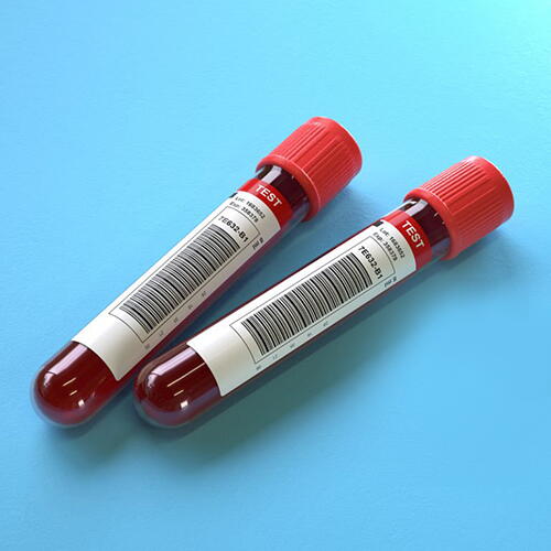 SUNDAY PACKAGE - FBS, PPBS, HBA1C