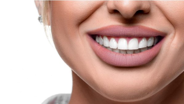 Hollywood Smile Makeover in Dubai – Star-Worthy Smiles