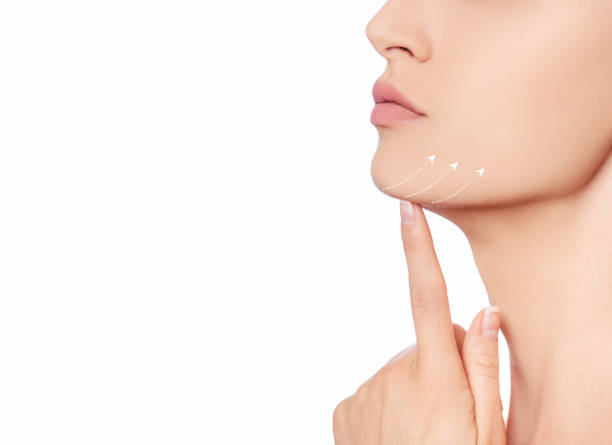 Neck Lift in Jeddah: Redefining Elegance and Youthfulness