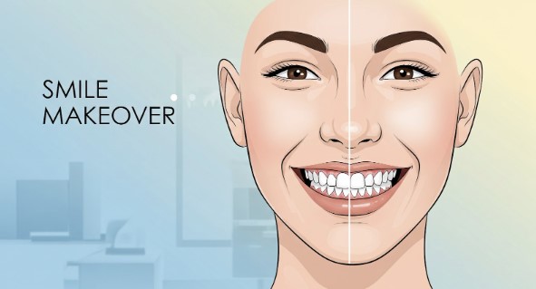 How a Smile Makeover Helps You Look Younger and More Vibrant
