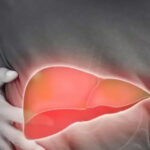 Fatty Liver: Difference Between Grade 1 and Grade 2 Explained