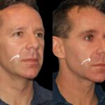 Best Aesthetic Clinic in Dubai for Hydrating Sculptra