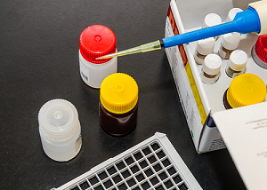 How CBX5 Antibody Advances Epigenetic and Cancer Research