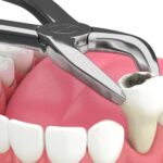 Your Best Smile: Restoring Health and Beauty with Advanced Dental Care