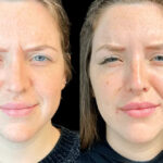 Top Qualities to Look for in the Best Plastic Surgeons in Dubai for Botox Treatments
