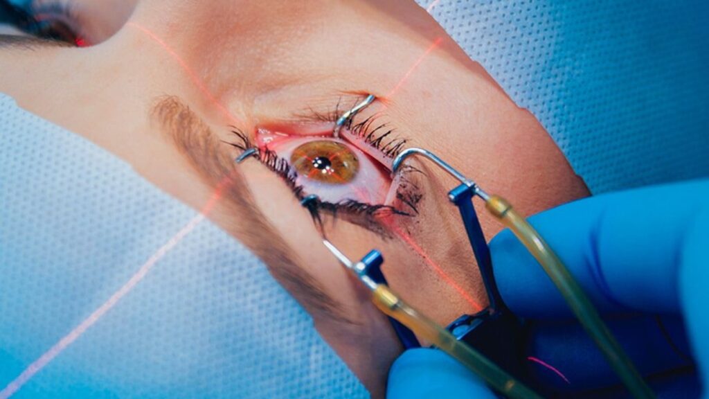 How to Choose the Best Eye Surgeon in Dubai for Your Vision