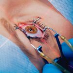 How to Choose the Best Eye Surgeon in Dubai for Your Vision