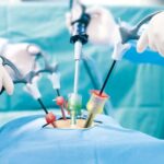 Guide to the Best Laparoscopic Surgeon in Dubai for Patients