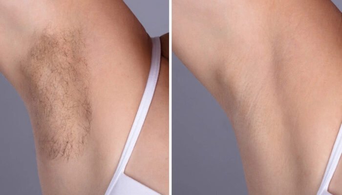 Best Plastic Surgeon in Dubai: Transforming Laser Hair Removal Results with Precision
