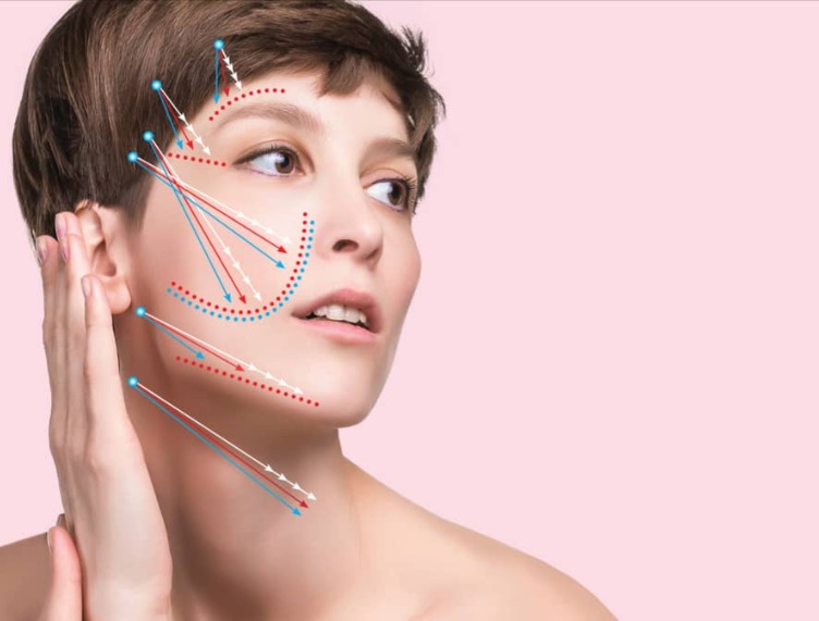 Patient Stories of Thread Lift in Dubai