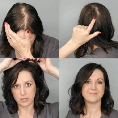 How Black Human Hair Toppers Provide Natural, Confident Solutions for Thinning Hair