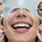 Popular Cosmetic Dental Options Explained for Patients