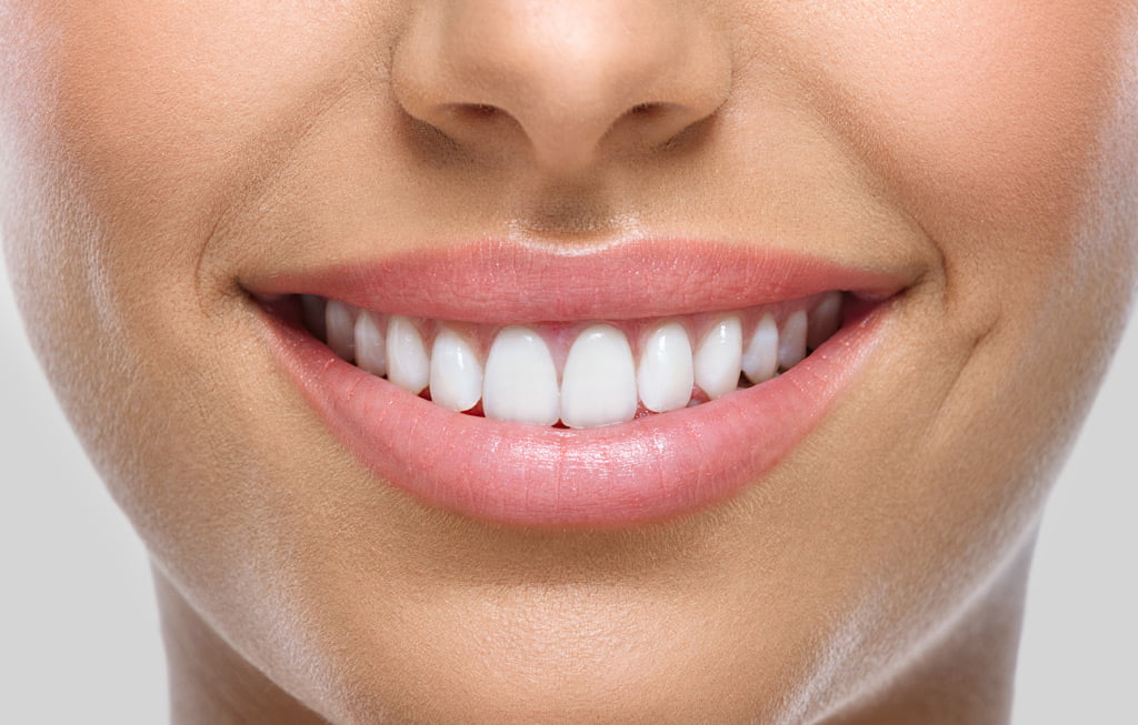 Reclaiming Your Smile: A Guide to Full Mouth Rehabilitation Treatment