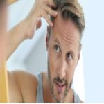 Best Hair Transplant In Florida
