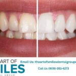 Emergency Dentist Near Me: Trusted Urgent Dental Care in Fontana