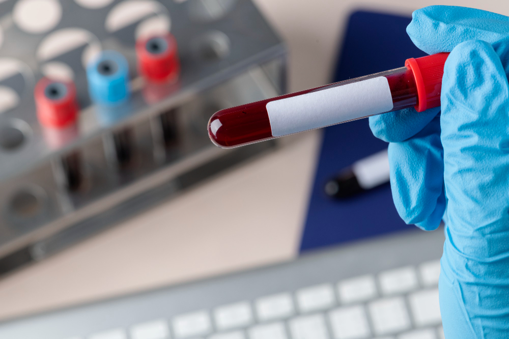 Is a Full Blood Test Package Suitable for Men and Women?