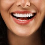 Beyond White Teeth: The Art of Perfecting Your Gumline in Gloucester