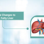 Lifestyle Changes to Prevent Fatty Liver: Small Steps with Big Impact