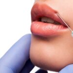 The Science Behind Lip Fillers: How They Work