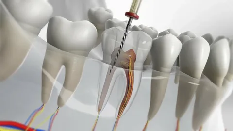 Save Your Smile with Modern Root Canal Treatments