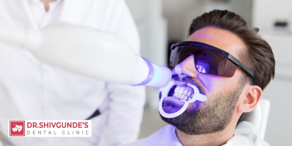 Dental Implants in Solapur for Long-Term Missing Teeth Treatment in Solapur