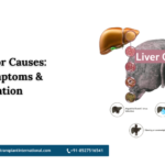 Liver Tumor Causes: Risks, Symptoms & Prevention