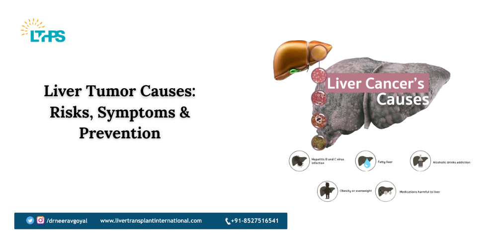 Liver Tumor Causes: Risks, Symptoms & Prevention