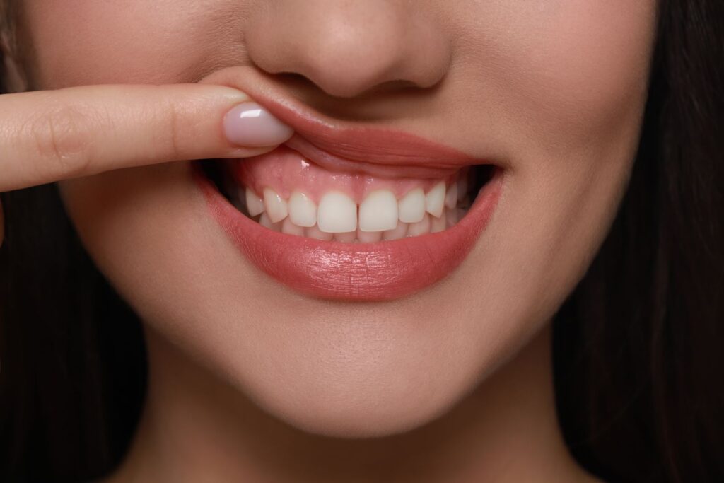 Why Healthy Gums Matter as Much as Healthy Teeth