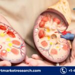 Chronic Inflammatory Demyelinating Polyneuropathy Treatment Market 2035