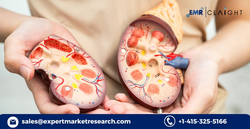 Chronic Inflammatory Demyelinating Polyneuropathy Treatment Market 2035