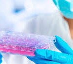 Why Patients Choose Frankfurt for Stem Cell Therapy