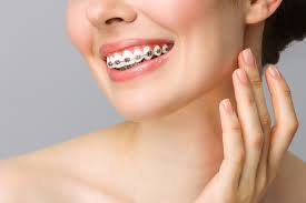 How Orthodontic Treatment Improves Dental Health and Smile Alignment