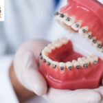 From Missing Teeth to Confident Smiles: Dental Implants in Bhubaneswar