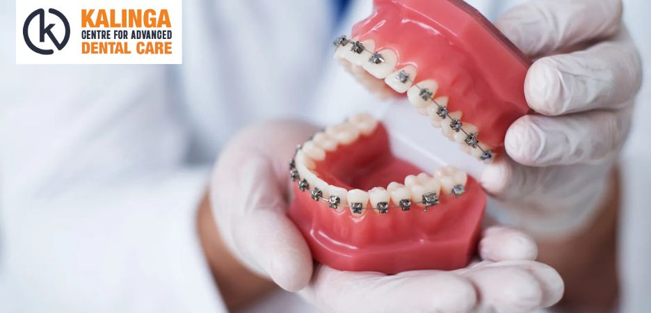 From Missing Teeth to Confident Smiles: Dental Implants in Bhubaneswar