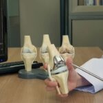 Trusted Orthopedic Doctor in Hyderabad | Dr PeReddy Ortho