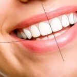 What Is Digital Smile Designing and How It Transforms Your Smile