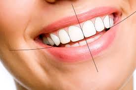 What Is Digital Smile Designing and How It Transforms Your Smile