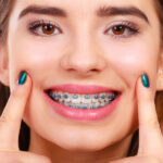 Different Types of Orthodontic Treatment Explained