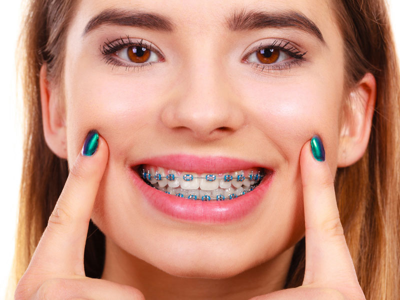 Different Types of Orthodontic Treatment Explained