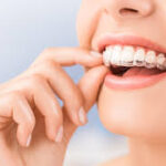 Invisalign Aligners in Ghatkopar: A Clear Path to a Confident Smile