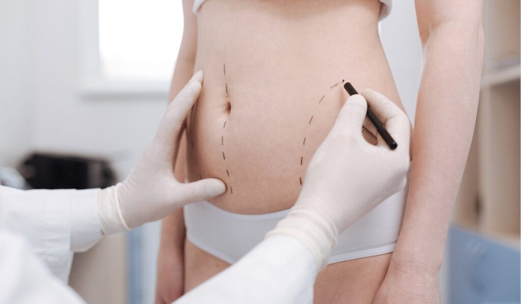Best Doctors in Dubai for Liposuction: Safe, Skilled, and Successful