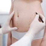 Best Doctors in Dubai for Liposuction: Safe, Skilled, and Successful